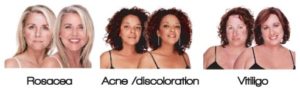 before-after